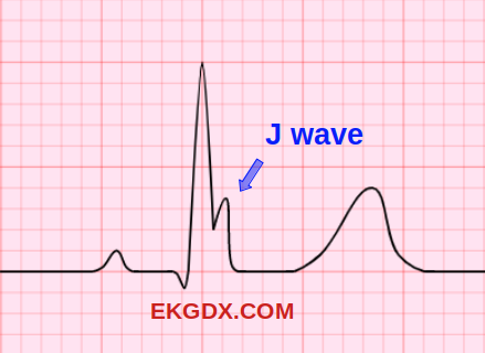 EKGDX - The new era of EKG learning